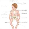 What does rickets look like? - Take a look at the diagram above.